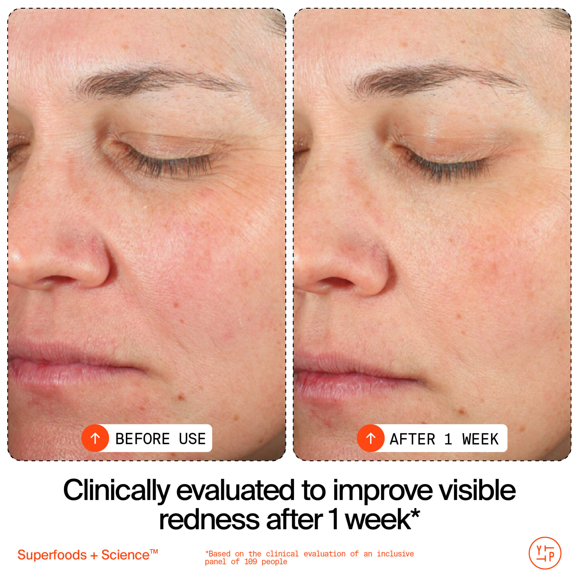 Adaptogen Skin Repairing Moisturizer with Peptides for Sensitive & Dry Skin