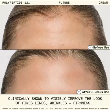 Polypeptide-121 Future Cream