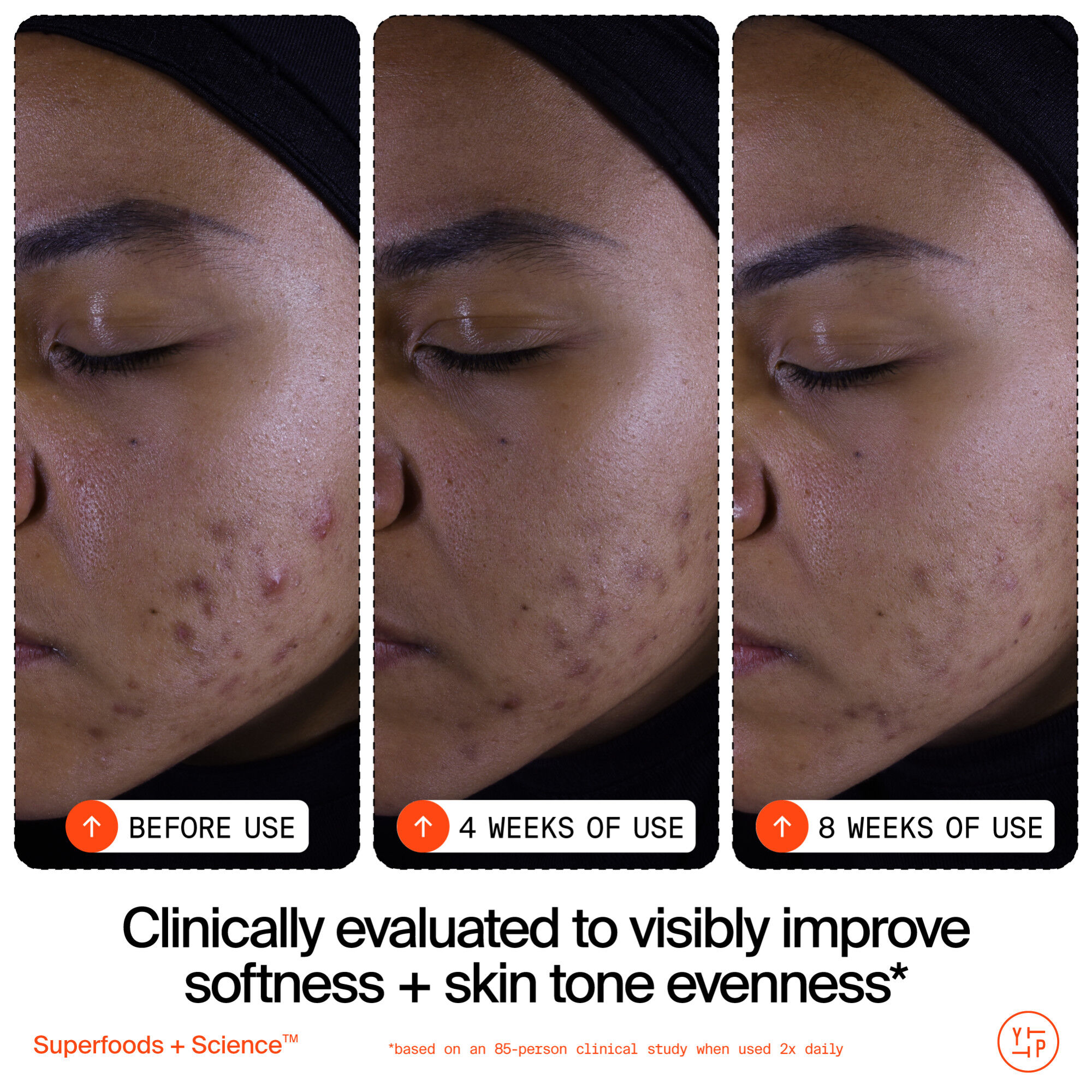 Superfruit Gentle Exfoliating Cleanser