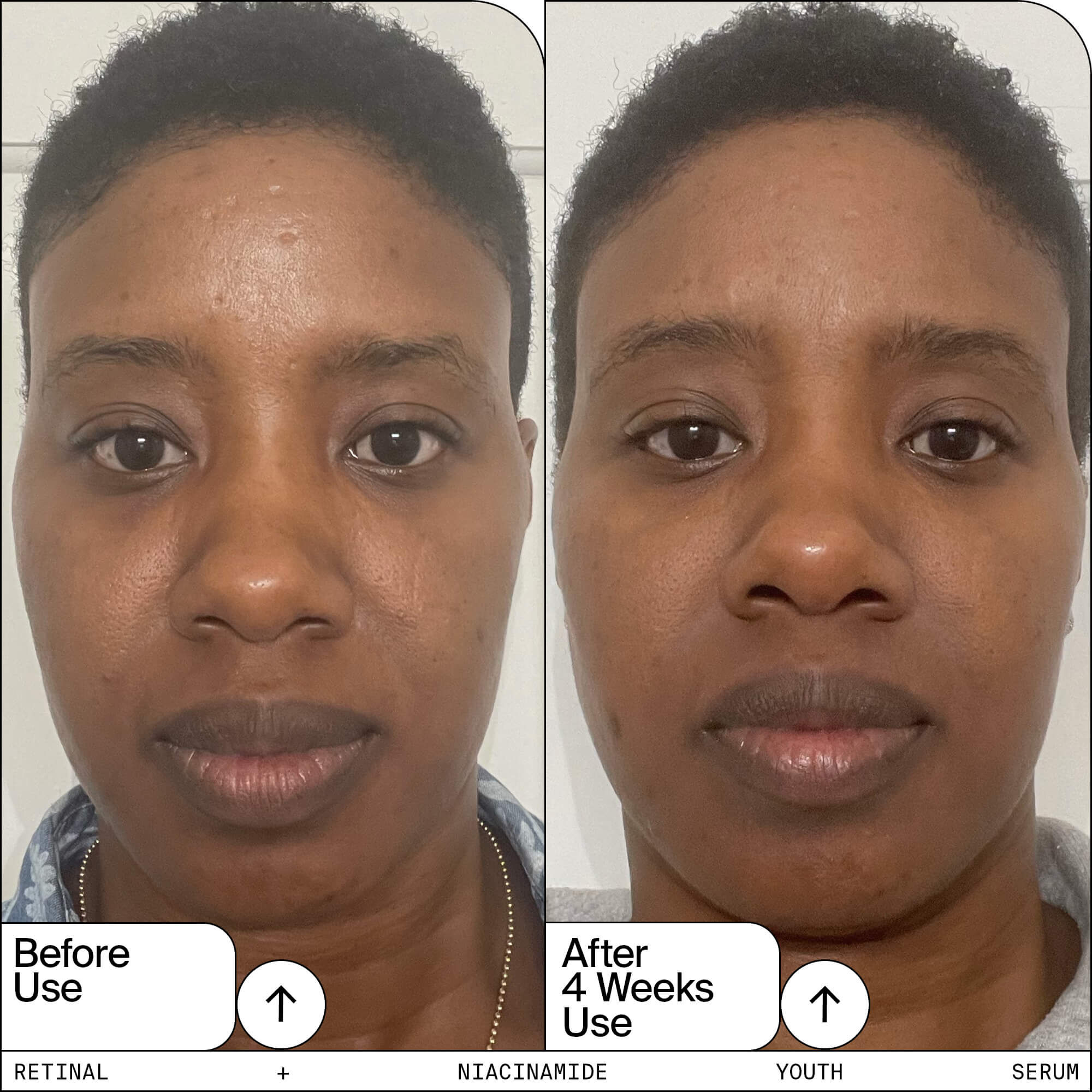 Retinal + Niacinamide Youth Serum