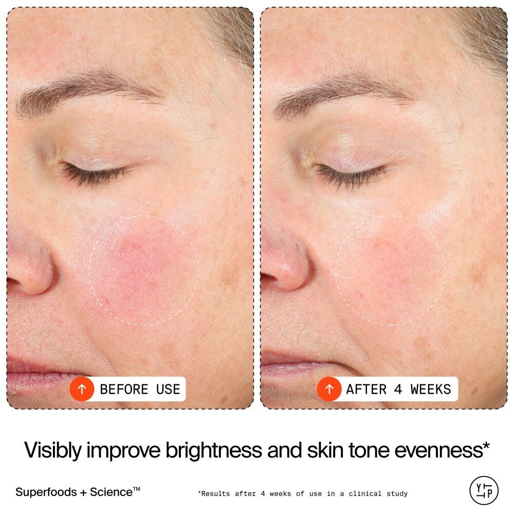 15% Vitamin C Bright Cell™ Serum