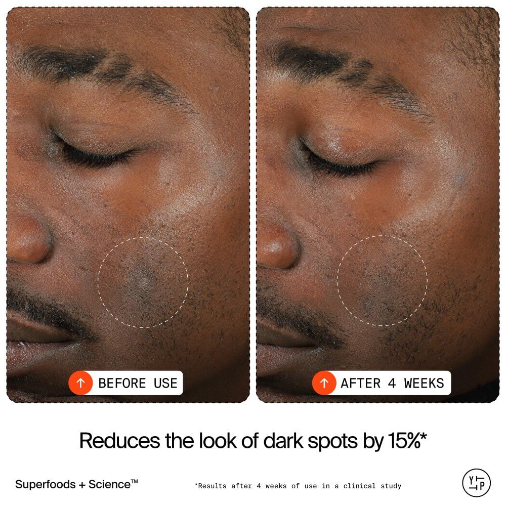 15% Vitamin C Bright Cell™ Serum