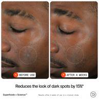 15% Vitamin C Bright Cell™ Serum