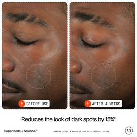 15% Vitamin C Bright Cell™ Serum