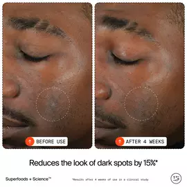 15% Vitamin C Bright Cell™ Serum