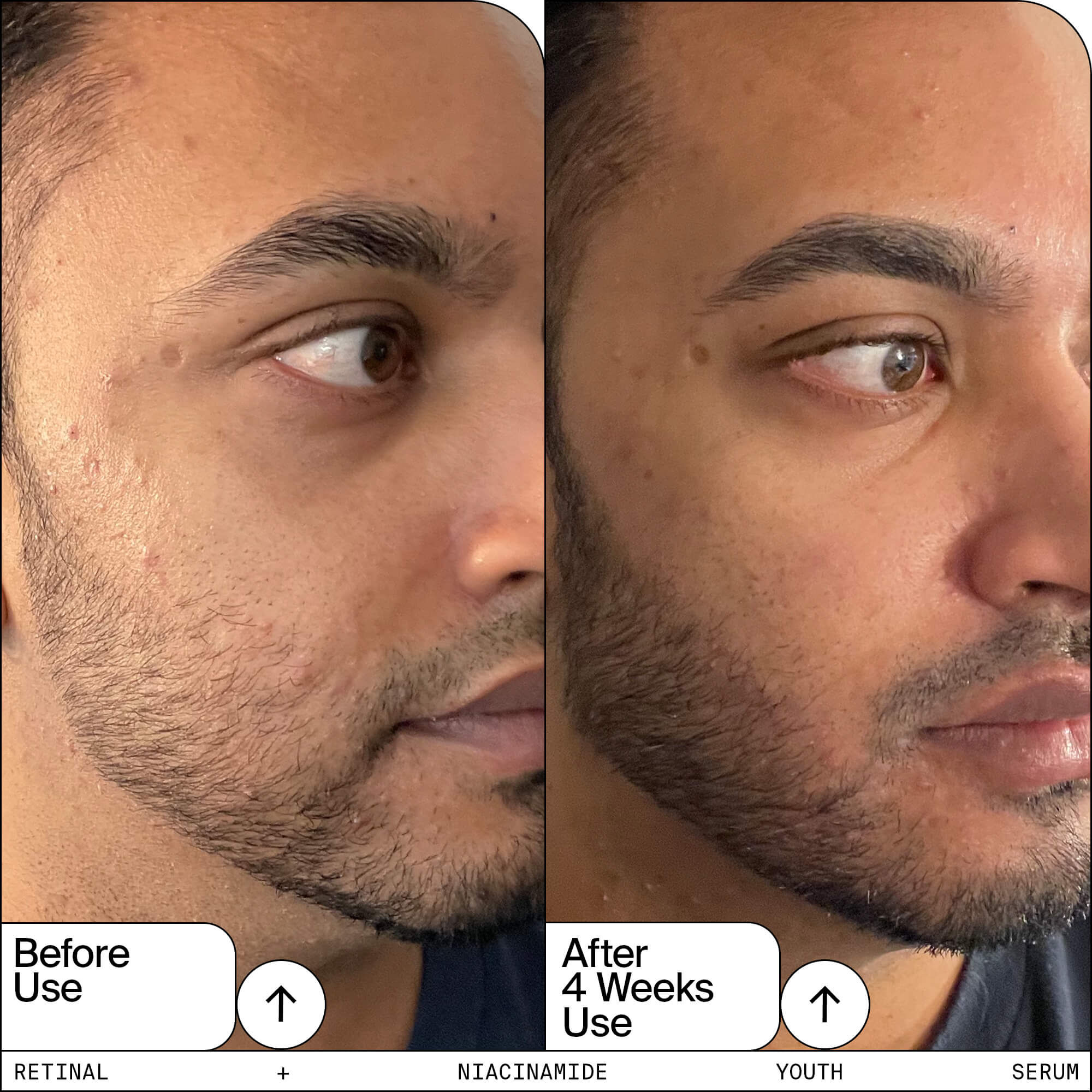 Retinal + Niacinamide Youth Serum