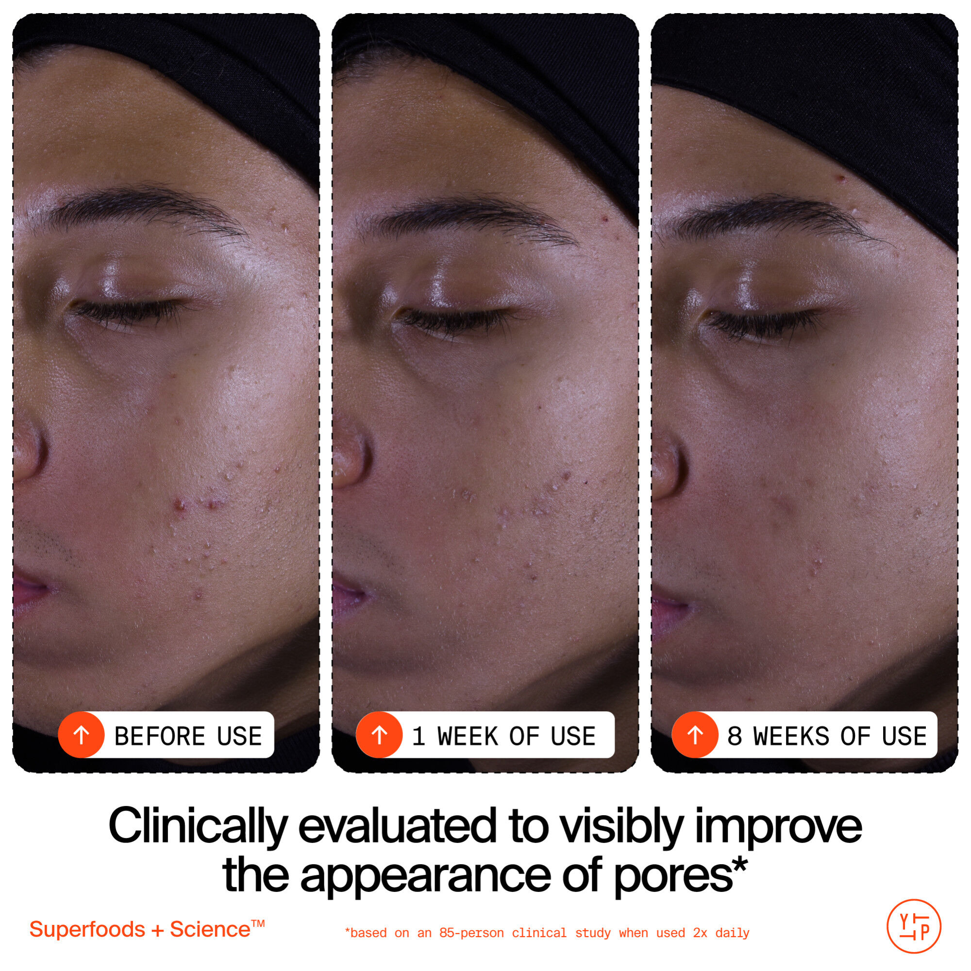 Superfruit Gentle Exfoliating Cleanser